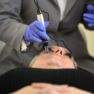 Едукација за Derma pen - Microneedling